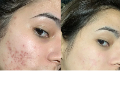 Set Facial Hidratante Milk